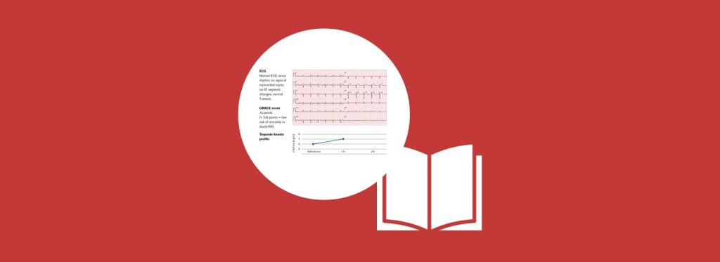 ECG, grace score and Troponin kinetic profile of 58-year old patient with acute chest pain, in front of a white open book, with a red backdrop.